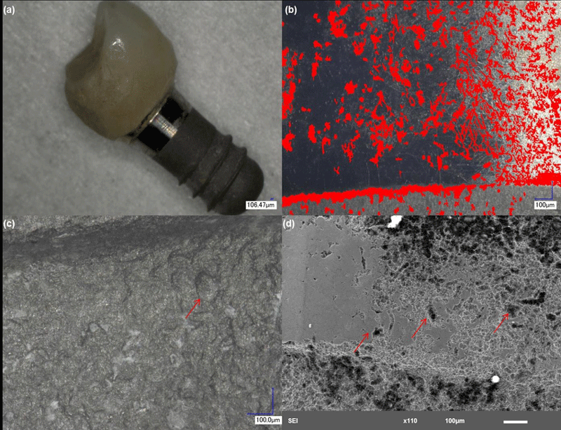 خوردگی و تجهیرات پزشکی